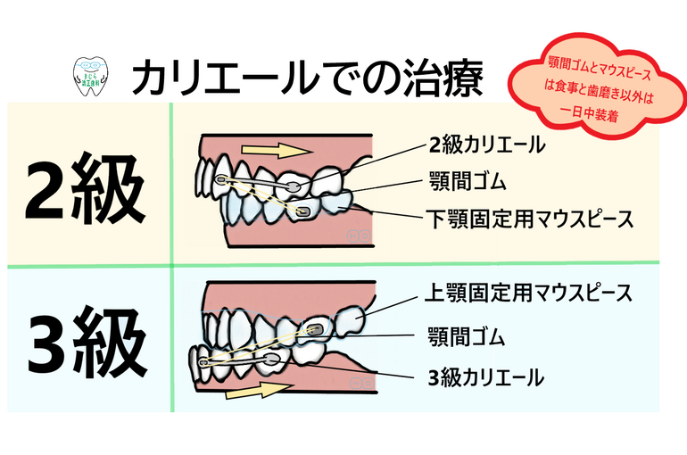 2級3級